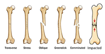 Physiology and Injuries in Sports (CH-7) Important Questions in English ...